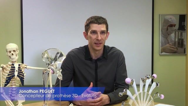 Le métier de concepteur de prothèse 3D